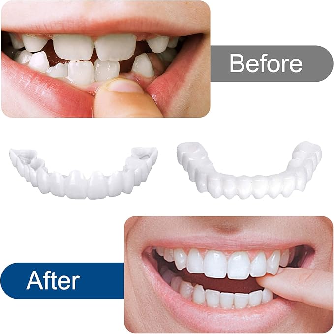 Snap-In Teeth for Men and Women